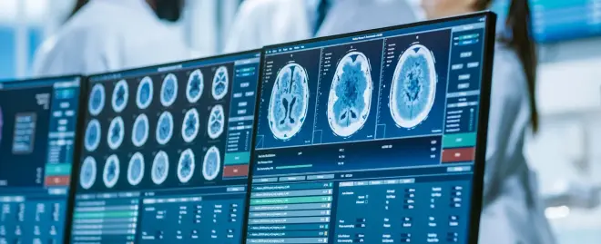 Medical Imaging Analysis Medical Imaging Analysis